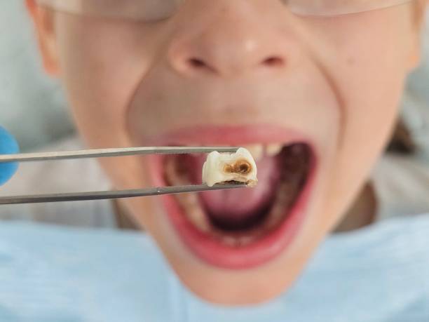 Best After-Hours Emergency Dentist in Wilber, NE