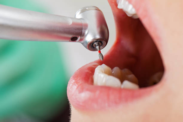Best Emergency Treatment for Toothache in Wilber, NE